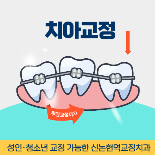 의정부치과 의정부시 치과 치아교정