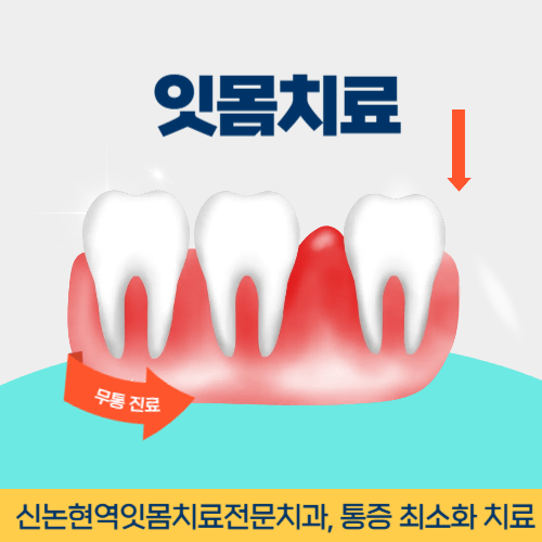 의정부치과 의정부시 치과 잇몸치료